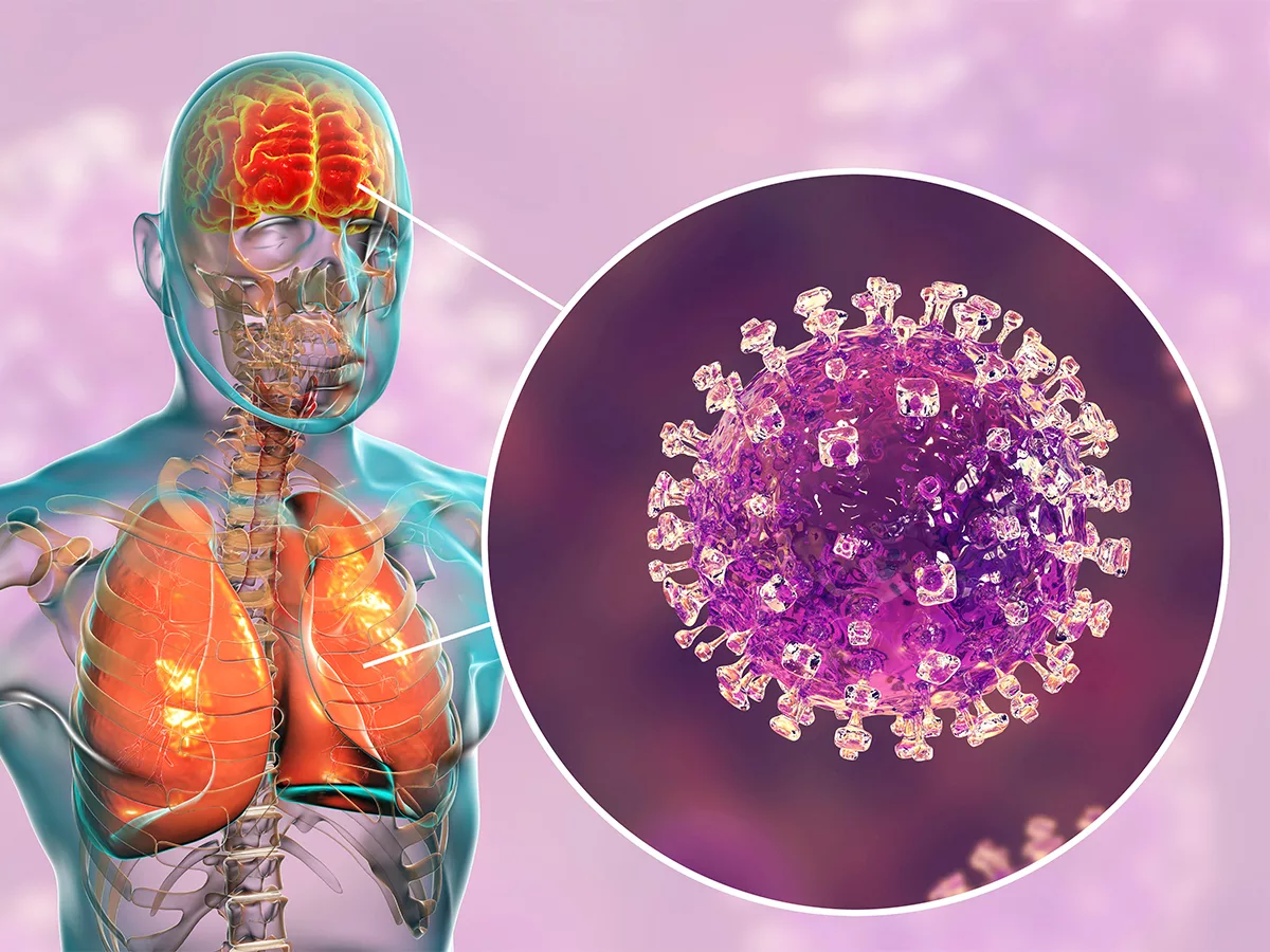 Anti-SARS-CoV-2 drug may also be effective against Nipah virus | BioWorld