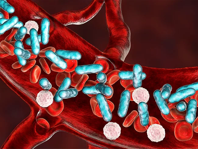 Illustration of bacteria in the bloodstream