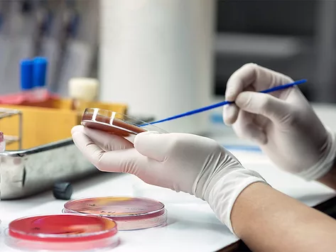 Bacteria culture drug resistance petri dish lab