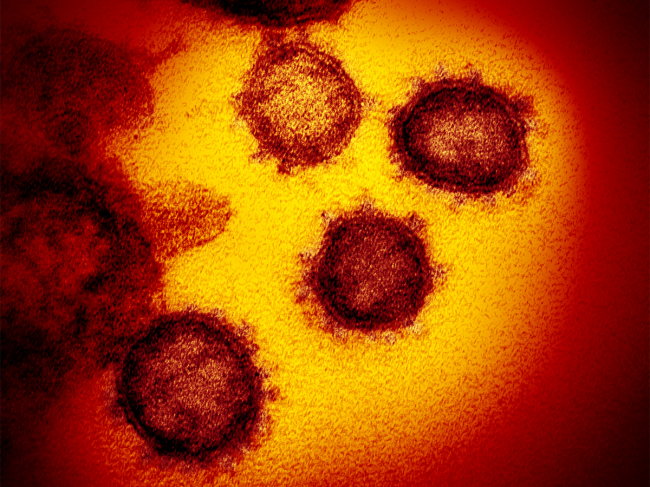 Coronavirus-SARS-CoV-2-NIH.png