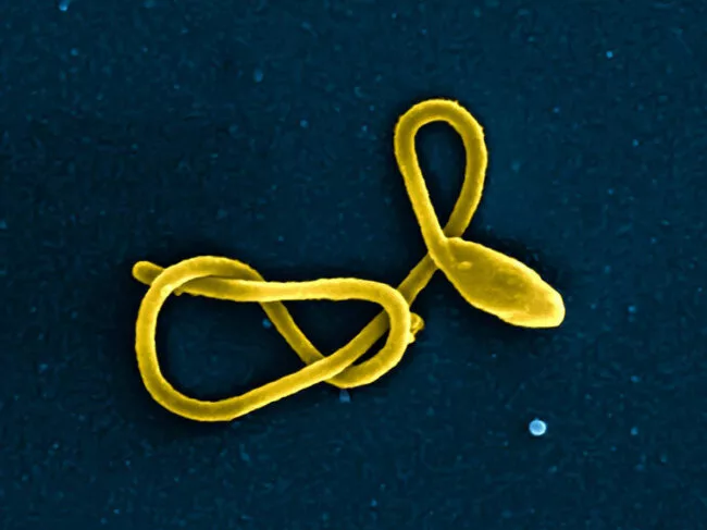 Ebola virus particle