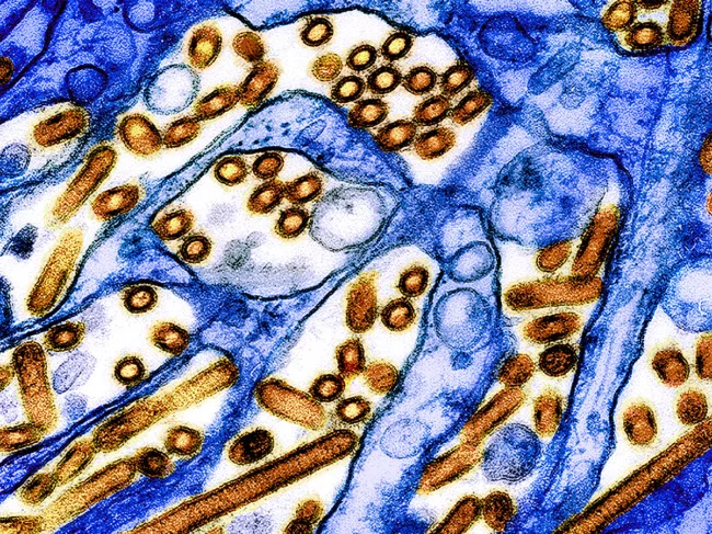 Colorized transmission electron micrograph of avian influenza A H5N1 virus particles