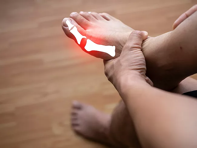 Inflammation in big toe