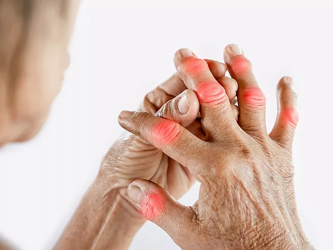 Hands highlighted with joint pain