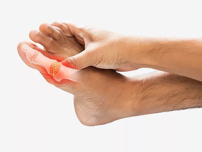 Hand holding painful foot