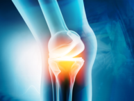 3D illustration of knee joint
