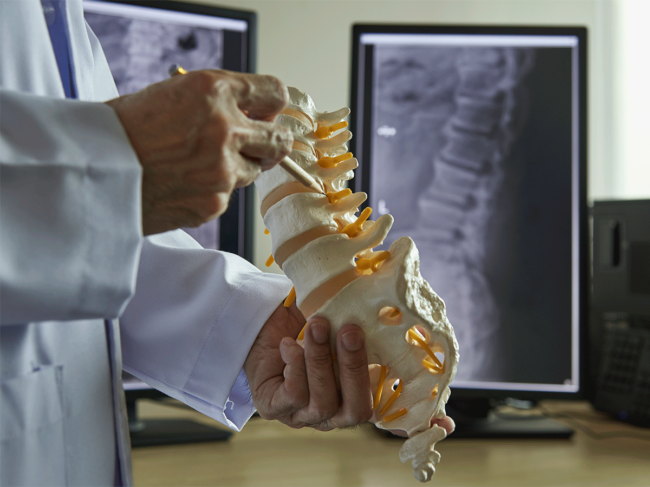 3D model, X-rays of spine