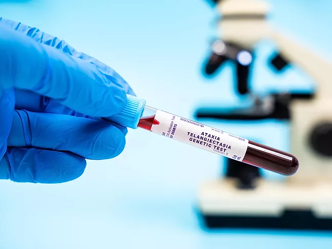 Gloved hand holding test tube marked for ataxia-telangiectasia genetic test