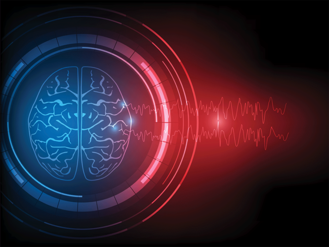 Epileptic brain and abnormal EEG wave discharges