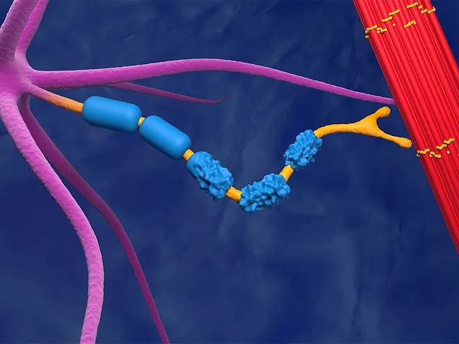 3D illustration of motor neuron damaged by amyotrophic lateral sclerosis