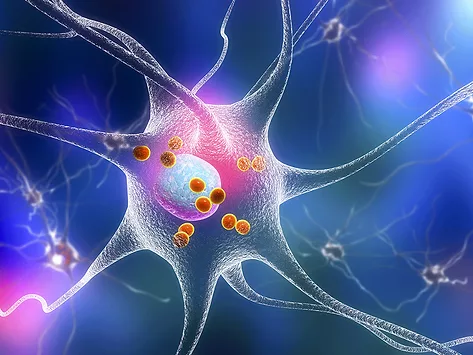Parkinson's disease illustration