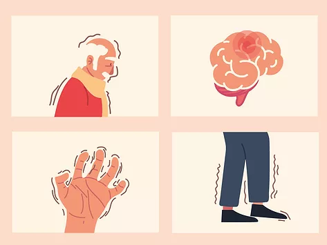 Parkinsons symptoms illustration