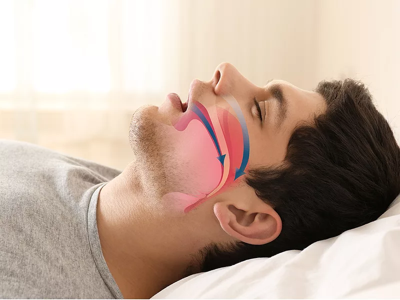 glp 1 approved for sleep apnea Lilly's GLP-1/GIP tirzepatide clears sleep apnea phase III hurdle