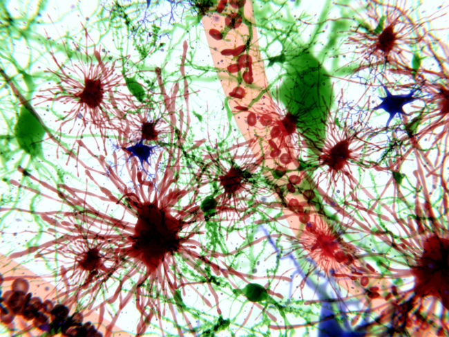 Brain cells and blood vessels
