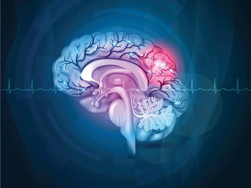 Cross-section of brain 