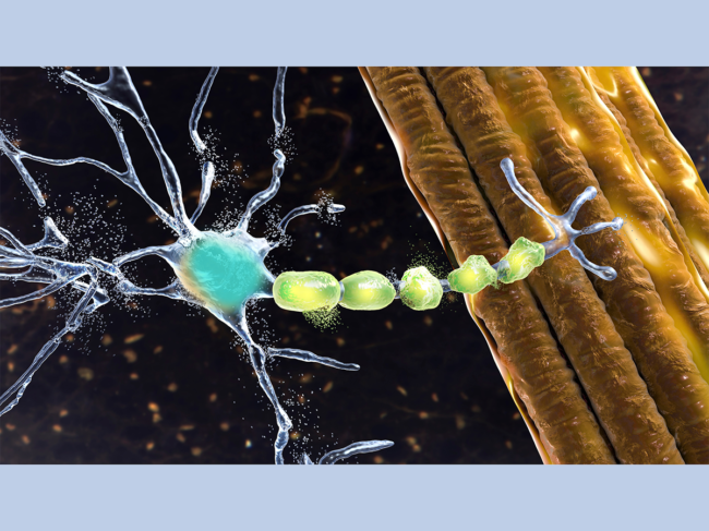 Conceptual 3D illustration showing degradation of motor neuron
