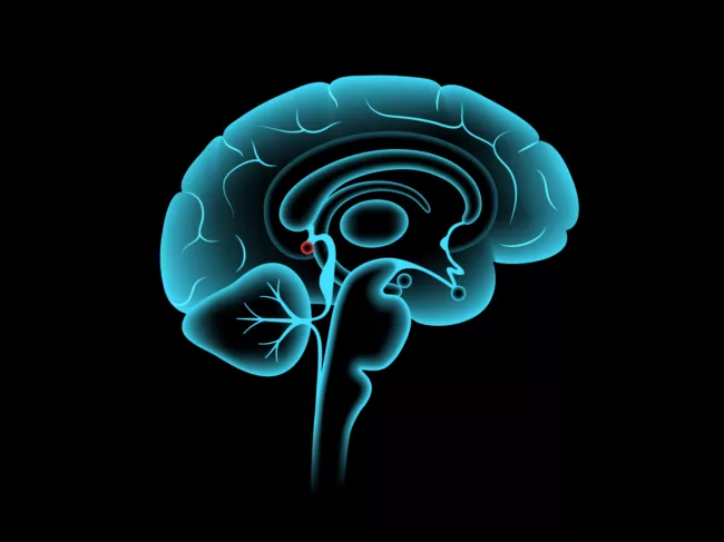 Illustration of brain cross-section showing the pineal gland