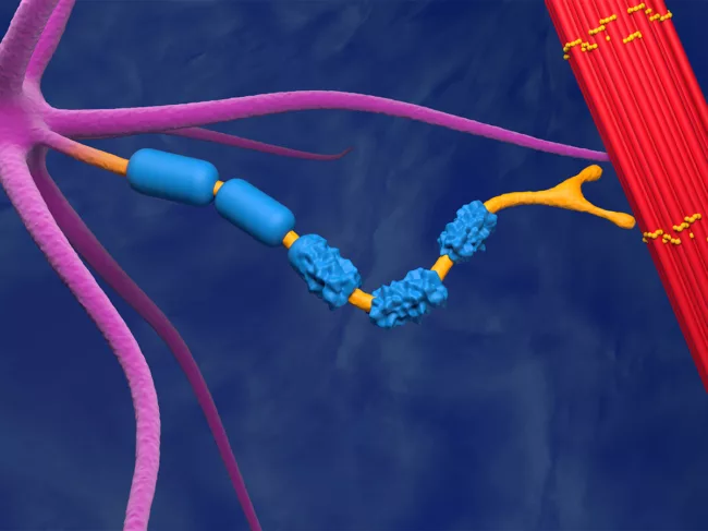 3D illustration of motor neuron damaged by amyotrophic lateral sclerosis