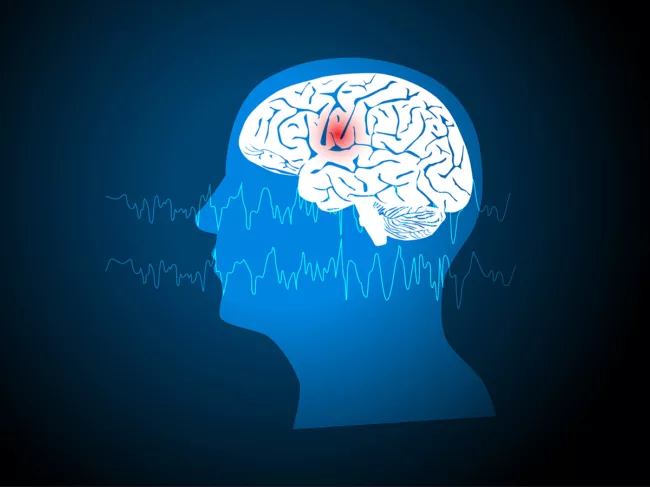 Seizure art concept with silhouette, brain, brain waves