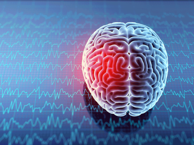 neurology-brain-injury