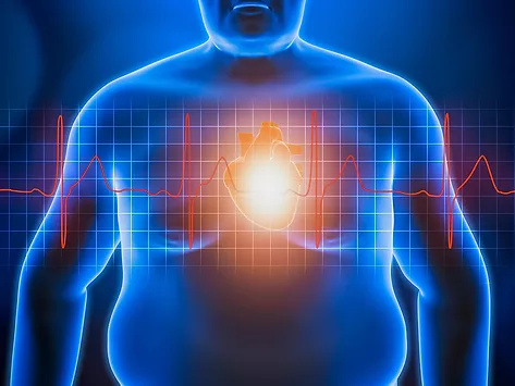 Obesity and heart disease illustration