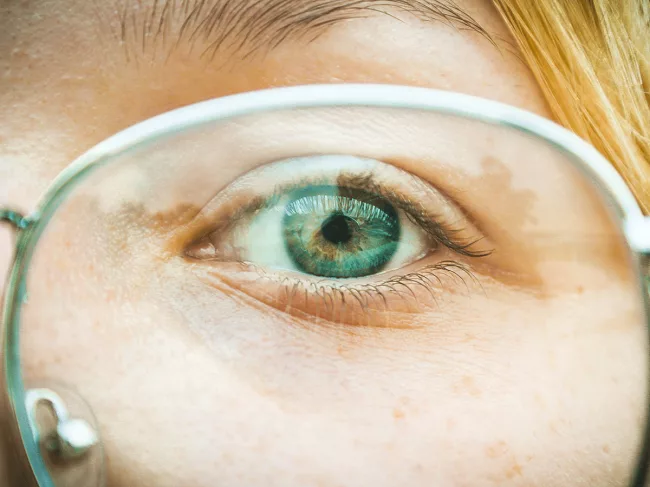 ocular-eyes1.png