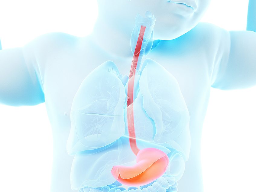 Lab-grown pig implant paves way to treat esophageal atresia