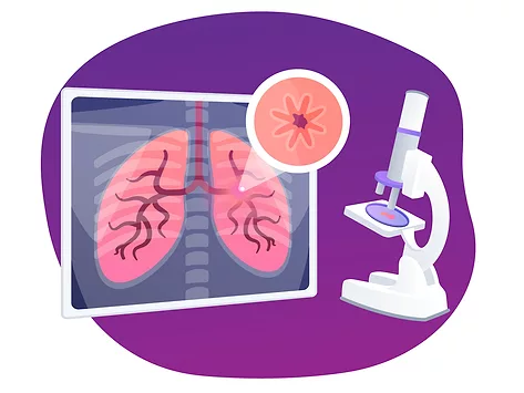 Copd chronic obstructive pulmonary disease research