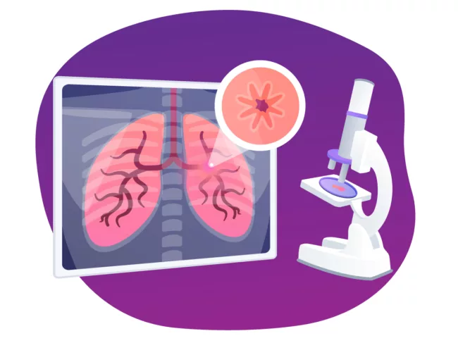 Illustration of lungs with microscope