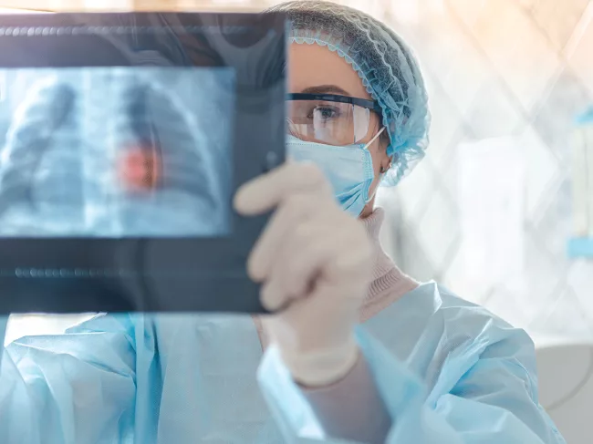 Doctor looking at lung scan