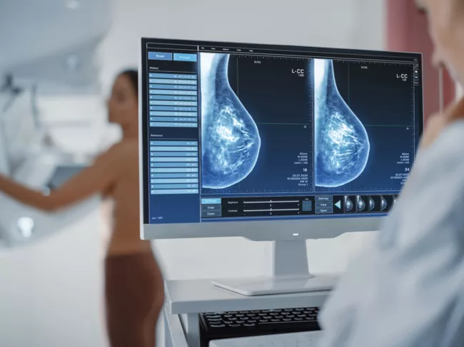 Mammography screening