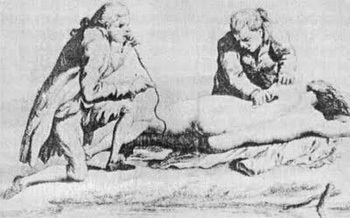 Rectal smoke was used in the 18th century to resuscitate nearly drowned victims